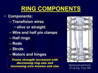 RING COMPONENTS
• Components:
– Transfixion wires
• olive or straight
– Wire and half pin clamps
– Half rings
– Rods
– Struts
– Motors and hinges
Rockwood and Green,
6th ed. Fig. 7-6 p. 260
Frame strength increased with
decreasing ring size and
increasing wire tension and size
 