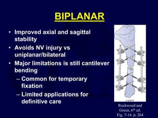 BIPLANAR
• Improved axial and sagittal
stability
• Avoids NV injury vs
uniplanar/bilateral
• Major limitations is still cantilever
bending
– Common for temporary
fixation
– Limited applications for
definitive care
Rockwood and
Green, 6th ed.
Fig. 7-14. p. 264
 