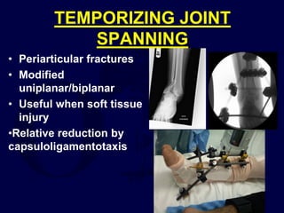 TEMPORIZING JOINT
SPANNING
• Periarticular fractures
• Modified
uniplanar/biplanar
• Useful when soft tissue
injury
•Relative reduction by
capsuloligamentotaxis
 