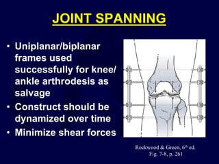 JOINT SPANNING
• Uniplanar/biplanar
frames used
successfully for knee/
ankle arthrodesis as
salvage
• Construct should be
dynamized over time
• Minimize shear forces
Rockwood & Green, 6th ed.
Fig. 7-8, p. 261
 