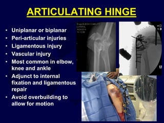 ARTICULATING HINGE
• Uniplanar or biplanar
• Peri-articular injuries
• Ligamentous injury
• Vascular injury
• Most common in elbow,
knee and ankle
• Adjunct to internal
fixation and ligamentous
repair
• Avoid overbuilding to
allow for motion
 