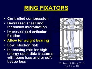 RING FIXATORS
• Controlled compression
• Decreased shear and
increased micromotion
• Improved peri-articular
fixation
• Allow for weight bearing
• Low infection risk
• Increasing role for high
energy open tibia fractures
with bone loss and or soft
tissue loss Rockwood & Green, 6th ed.
Fig. 7-6. p. 260
 
