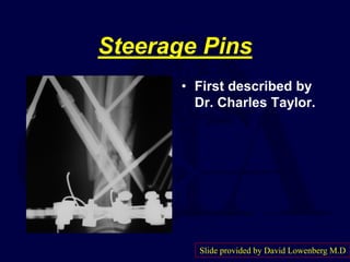 Steerage Pins
• First described by
Dr. Charles Taylor.
Slide provided by David Lowenberg M.D
 