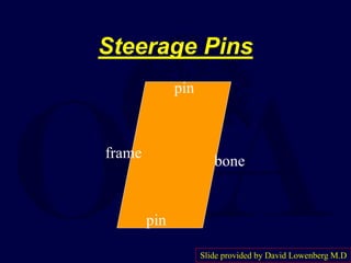 Steerage Pins
frame
bone
pin
pin
Slide provided by David Lowenberg M.D
 