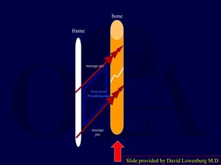 frame
bone
steerage pin
steerage
pin
Structural
Parallelogram
Slide provided by David Lowenberg M.D
 