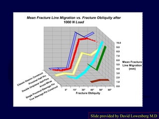 0.0
1.0
2.0
3.0
4.0
5.0
6.0
7.0
8.0
9.0
10.0
Mean Fracture
Line Migration
(mm)
0° 15° 30° 40° 50° 60°
Classic Ilizarov Construct
Proximal Half Pin
Double Uniplanar Half Pins
Arced Wires
Single Proximal Steerage Pin
True Steerage Pin Construct
Fracture Obliquity
Mean Fracture Line Migration vs. Fracture Obliquity after
1000 N Load
Slide provided by David Lowenberg M.D
 