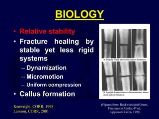 BIOLOGY
• Relative stability
• Fracture healing by
stable yet less rigid
systems
– Dynamization
– Micromotion
– Uniform compression
• Callus formation
(Figures from: Rockwood and Green,
Fractures in Adults, 4th ed,
Lippincott-Raven, 1996)
Kenwright, CORR, 1998
Larsson, CORR, 2001
 