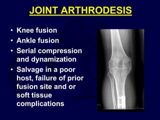 JOINT ARTHRODESIS
• Knee fusion
• Ankle fusion
• Serial compression
and dynamization
• Salvage in a poor
host, failure of prior
fusion site and or
soft tissue
complications
 