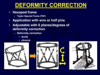 DEFORMITY CORRECTION
• Hexapod frame
– Taylor Spacial Frame (TSF)
• Application with wire or half pins
• Adjustable with 6 planes/degrees of
deformity correction
– Deformity correction
• acute
• chronic
 