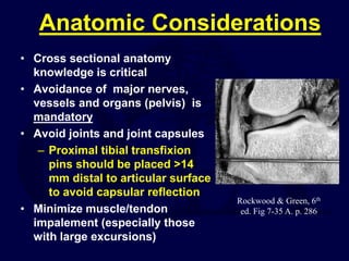 Anatomic Considerations
• Cross sectional anatomy
knowledge is critical
• Avoidance of major nerves,
vessels and organs (pelvis) is
mandatory
• Avoid joints and joint capsules
– Proximal tibial transfixion
pins should be placed >14
mm distal to articular surface
to avoid capsular reflection
• Minimize muscle/tendon
impalement (especially those
with large excursions)
Rockwood & Green, 6th
ed. Fig 7-35 A. p. 286
 