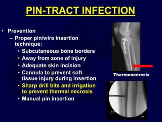 PIN-TRACT INFECTION
• Prevention
– Proper pin/wire insertion
technique:
• Subcutaneous bone borders
• Away from zone of injury
• Adequate skin incision
• Cannula to prevent soft
tissue injury during insertion
• Sharp drill bits and irrigation
to prevent thermal necrosis
• Manual pin insertion
Thermonecrosis
 