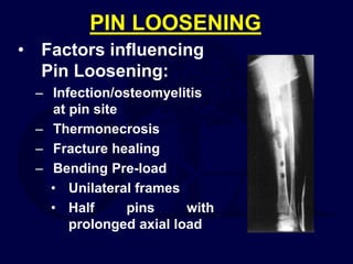 PIN LOOSENING
• Factors influencing
Pin Loosening:
– Infection/osteomyelitis
at pin site
– Thermonecrosis
– Fracture healing
– Bending Pre-load
• Unilateral frames
• Half pins with
prolonged axial load
 