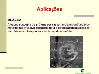 Aplicações
MEDICINA
A espectroscopia de prótons por ressonância magnética é um
método não invasivo que possibilita a detecção de alterações
metabólicas e bioquímicas de áreas do encéfalo.

U NIVERSIDAD E EDUARDO

 