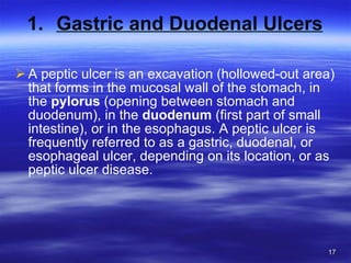 Gastric and Duodenal Ulcers A peptic ulcer is an excavation (hollowed-out area) that forms in the mucosal wall of the stomach, in the  pylorus  (opening between stomach and duodenum), in the  duodenum  (first part of small intestine), or in the esophagus. A peptic ulcer is frequently referred to as a gastric, duodenal, or esophageal ulcer, depending on its location, or as peptic ulcer disease. 