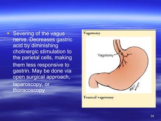 Severing of the vagus nerve. Decreases gastric acid by diminishing cholinergic stimulation to the parietal cells, making them less responsive to gastrin. May be done via open surgical approach, laparoscopy, or thoracoscopy 