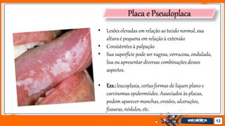 Jens Martensson 12
Placa e Pseudoplaca
• Lesões elevadas em relação ao tecido normal, sua
altura é pequena em relação à extensão
• Consistentes à palpação
• Sua superfície pode ser rugosa, verrucosa,ondulada,
lisa ou apresentar diversas combinações desses
aspectos.
• Exs.:leucoplasia, certas formas de líquen plano e
carcinomas epidermóides. Associados às placas,
podem aparecer manchas, erosões, ulcerações,
fissuras, nódulos, etc.
 