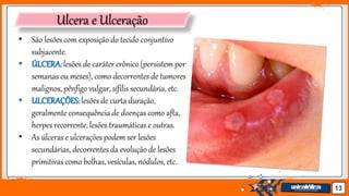 Jens Martensson 13
Ulcera e Ulceração
• São lesões com exposição do tecido conjuntivo
subjacente.
• ÚLCERA:lesões de caráter crônico (persistem por
semanas ou meses), como decorrentes de tumores
malignos, pênfigo vulgar, sífilis secundária, etc.
• ULCERAÇÕES:lesões de curta duração,
geralmente consequênciade doenças como afta,
herpes recorrente, lesões traumáticas e outras.
• As úlcerase ulcerações podem ser lesões
secundárias, decorrentes da evoluçãode lesões
primitivas como bolhas, vesículas, nódulos, etc.
 