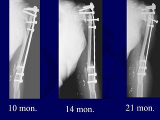 10 mon. 14 mon. 21 mon.
 