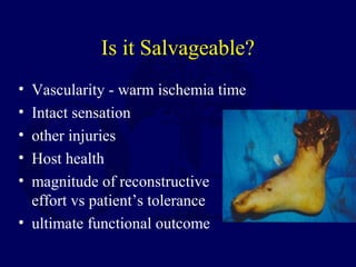 Is it Salvageable?
• Vascularity - warm ischemia time
• Intact sensation
• other injuries
• Host health
• magnitude of reconstructive
effort vs patient’s tolerance
• ultimate functional outcome
 