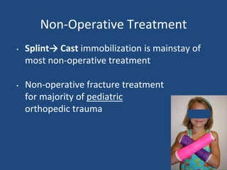 Non-Operative Treatment
• Splint→ Cast immobilization is mainstay of
most non-operative treatment
• Non-operative fracture treatment
for majority of pediatric
orthopedic trauma
 