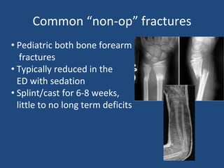 Common “non-op” fractures
• Pediatric both bone forearm
fractures
• Typically reduced in the
ED with sedation
• Splint/cast for 6-8 weeks,
little to no long term deficits
 