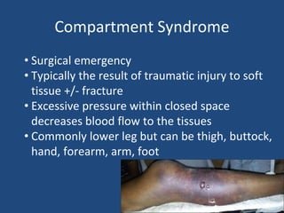 Compartment Syndrome
• Surgical emergency
• Typically the result of traumatic injury to soft
tissue +/- fracture
• Excessive pressure within closed space
decreases blood flow to the tissues
• Commonly lower leg but can be thigh, buttock,
hand, forearm, arm, foot
 