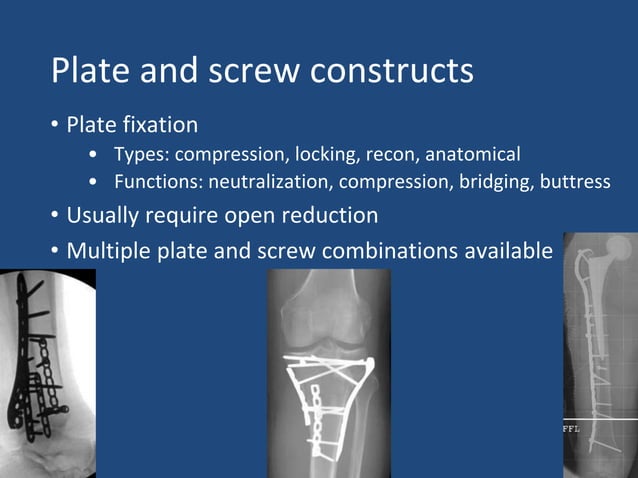 ortho-trauma-presentation | PPTX
