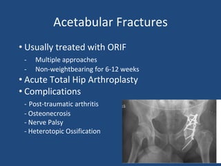 Acetabular Fractures
• Usually treated with ORIF
- Multiple approaches
- Non-weightbearing for 6-12 weeks
• Acute Total Hip Arthroplasty
• Complications
- Post-traumatic arthritis
- Osteonecrosis
- Nerve Palsy
- Heterotopic Ossification
 