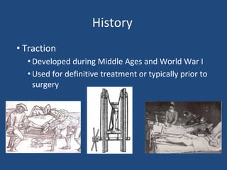 History
• Traction
• Developed during Middle Ages and World War I
• Used for definitive treatment or typically prior to
surgery
 
