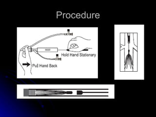 Procedure 