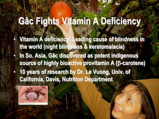 Gâc Fights Vitamin A Deficiency
• Vitamin A deficiency: Leading cause of blindness in
  the world (night blindness & keratomalacia)
• In So. Asia, Gâc discovered as potent indigenous
  source of highly bioactive provitamin A (b-carotene)
• 10 years of research by Dr. Le Vuong, Univ. of
  California, Davis, Nutrition Department




      *Vuong LT et al., Am J Clin Nutr 2002;75:872-879.
 