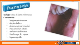 Jens Martensson 12
Etiologia: Falhas de fusões embrionárias
Características:
• Invaginações da mucosa
• Ângulos da boca
• Arcos mandibular e maxilar
• Mais comum em adultos
• Unilaterais ou bilaterais
• Fístulas cegas de 1 a 4 mm
• Líquido expelido
 