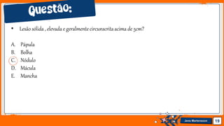 Jens Martensson 19
• Lesão sólida , elevada e geralmente circunscritaacima de 5cm?
A. Pápula
B. Bolha
C. Nódulo
D. Mácula
E. Mancha
 