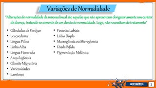 Jens Martensson 2
Variações de Normalidade
“Alteraçõesdenormalidadedamucosabucalsãoaquelasquenãoapresentamobrigatoriamenteumcaráter
de doença,tratando-sesomentedeumdesviodenormalidade.Logo,nãonecessitamdetratamento’’
• Glândulas de Fordyce
• Leucoedema
• Língua Pilosa
• Linha Alba
• Língua Fissurada
• Anquiloglossia
• Glossite Migratória
• Varicosidades
• Exostoses
• Fossetas Labiais
• Lábio Duplo
• Macroglossia ou Microglossia
• Úvula Bífida
• Pigmentação Melânica
 