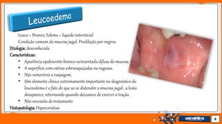 Jens Martensson 4
Leuco = Branco; Edema = liquido intersticial
Condição comum da mucosa jugal. Predileção por negros.
Etiologia: desconhecida.
Características:
• Aparência opalescente branco-acinzentada difusa da mucosa.
• A superfície com estrias esbranquiçadas ou rugosas.
• Não removíveis a raspagem.
• Um elemento clínico extremamente importante no diagnóstico do
leucoedema é o fato de que ao se distender a mucosa jugal , a lesão
desaparece, retornando quando deixamos de exercer a tração.
• Não necessita de tratamento
Histopatologia:Hiperceratose
 