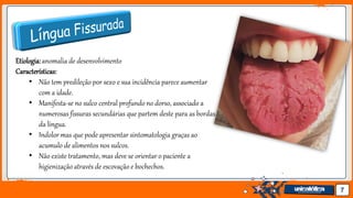 Jens Martensson 7
Etiologia:anomalia de desenvolvimento
Características:
• Não tem predileção por sexo e sua incidência parece aumentar
com a idade.
• Manifesta-se no sulco central profundo no dorso, associado a
numerosas fissuras secundárias que partem deste para as bordas
da língua.
• Indolor mas que pode apresentar sintomatologia graças ao
acumulo de alimentos nos sulcos.
• Não existe tratamento, mas deve se orientar o paciente a
higienização através de escovação e bochechos.
 