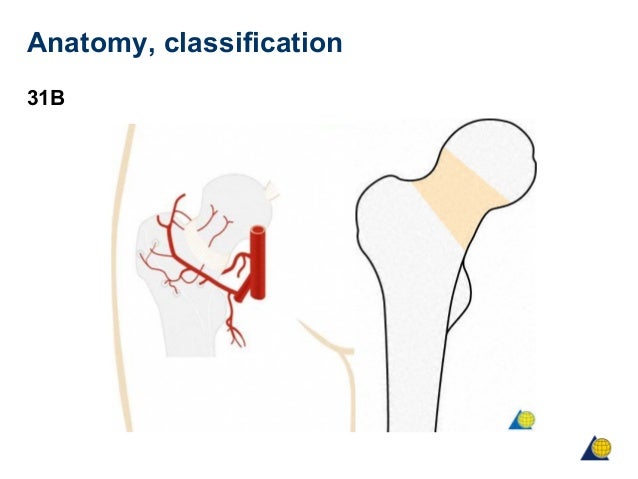 Femoral Neck Anatomy