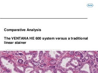 Confidential and proprietary to Ventana Medical Systems, Inc. For internal use only. Do not copy. Do not distribute.
Comparative Analysis
The VENTANA HE 600 system versus a traditional
linear stainer
 