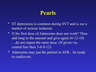 Svt Depression g459h_supraventricular-tachycardia ecg.pptx