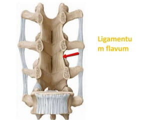 Ligamentu
m flavum
 