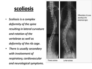 scoliosis
• Scoliosis is a complex
deformity of the spine
resulting in lateral curvature
and rotation of the
vertebrae as well as
deformity of the rib cage.
• There is usually secondary
with involvement of
respiratory, cardiovascular
and neurological symptoms.
 