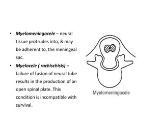 • Myelomeningocele – neural
tissue protrudes into, & may
be adherent to, the meningeal
sac.
• Myelocele ( rachischisis) –
failure of fusion of neural tube
results in the production of an
open spinal plate. This
condition is incompatible with
survival.
 