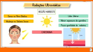 Jens Martensson 21
Radiações Ultravioletas
CARCINOMA
Danos na Fibra Elástica
Mudança no Sistema Imune
REGIÃO NORDESTE
Lábio Inferior
Menor espessura de queratina
Pouca quantidade de melanina
 