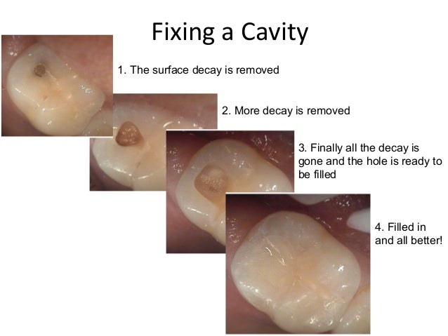 Teeth For Grade 5
