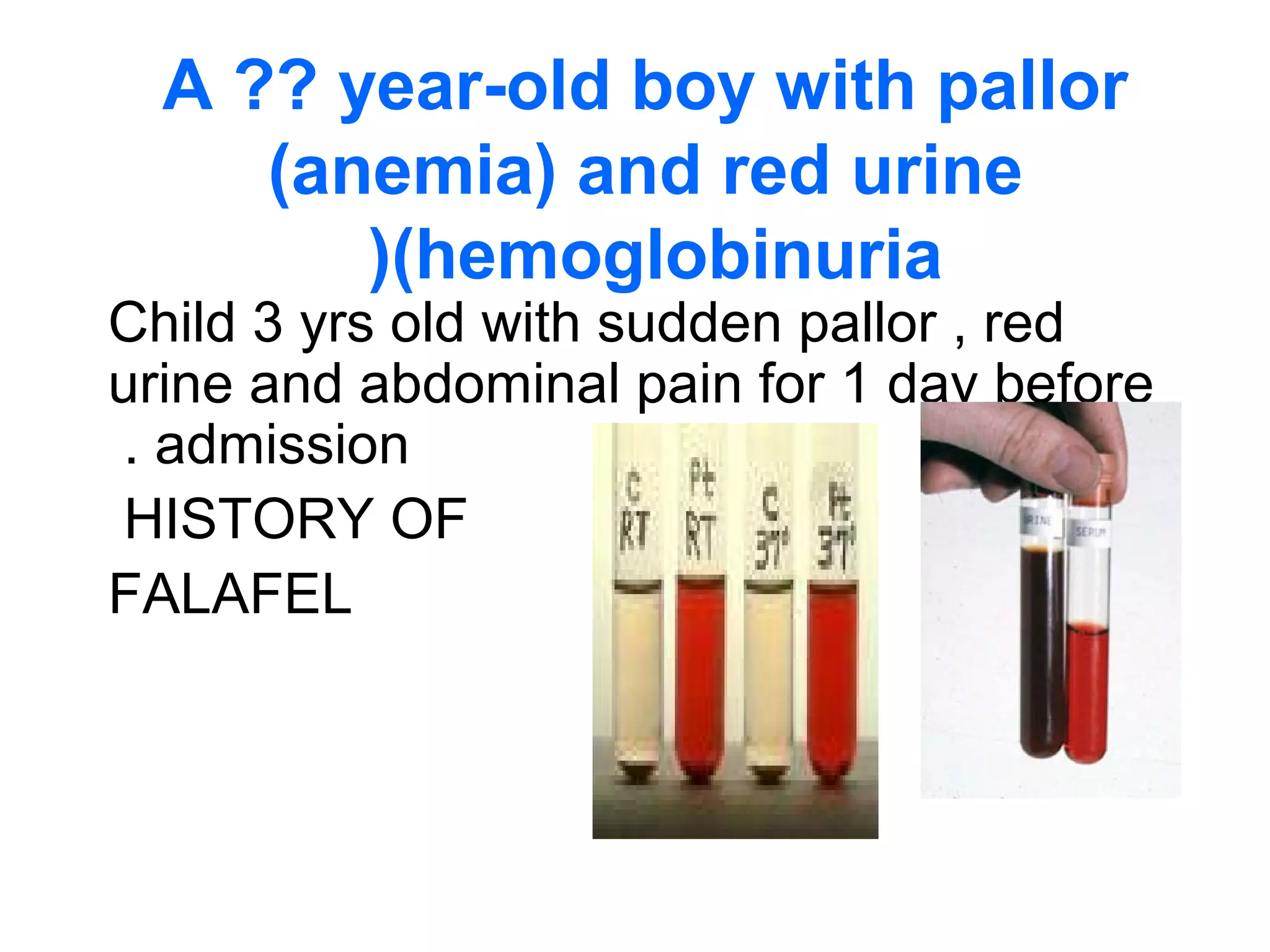 A ?? year-old boy with pallor
(anemia) and red urine
(hemoglobinuria)
Child 3 yrs old with sudden pallor , red
urine and abdominal pain for 1 day before
admission.
HISTORY OF
FALAFEL
 
