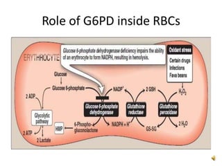Glucose 6 phosphate dehydrgenase deficiency syndrome | PPTX