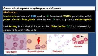 GIucose-6-phosphate dehydrogenase deficiency
Mechanism :
Inadequate amounts of GSH lead to  Decreased NADPH generation which
protect the Fe2- hemoglobin inside the RBC  lead to produce methemoglobin
and forming little inclusions known as the “Heinz bodies, Which removed by
spleen (Bite and Blister cells)
ANEMIA -Dr.Alagbare
 