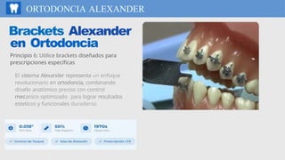 Brackets Alexander Principio 6: Uso de Brackets Específicos en Ortodoncia Alexander para ...
