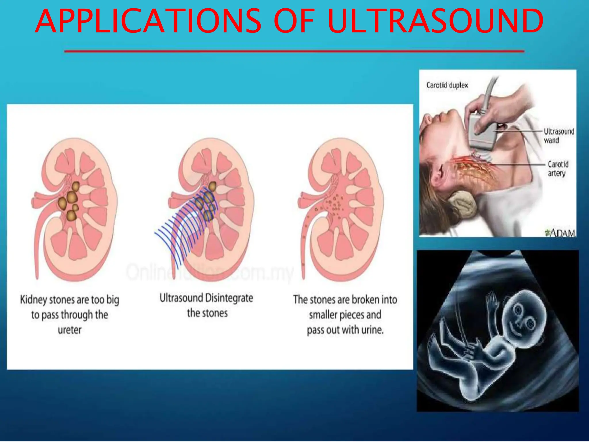 APPLICATIONS OF ULTRASOUND
 