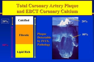 20%20%
80%80%
Total Coronary Artery PlaqueTotal Coronary Artery Plaque
and EBCT Coronary Calciumand EBCT Coronary Calcium
80%80%
PlaquePlaque
DetectableDetectable
by IVUS,by IVUS,
PathologyPathology
Lipid RichLipid Rich
FibroticFibrotic
CalcifiedCalcified 20%20%
80%80%
 